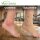6er Pack Elastische Fixierbinde Verbandstoff Textilbandage Flexibel Beige 75mm